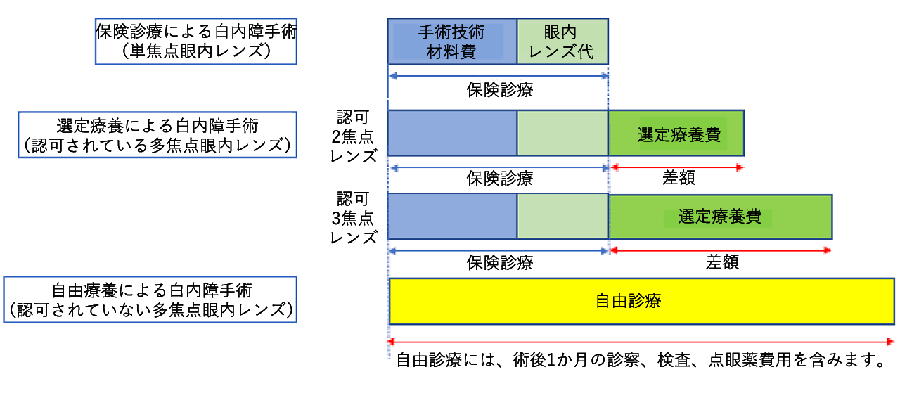 多焦点眼内レンズの費用内訳について