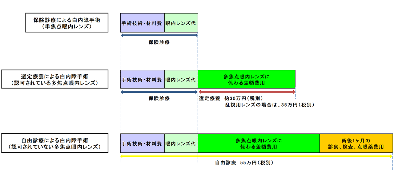 多焦点眼内レンズの費用内訳について