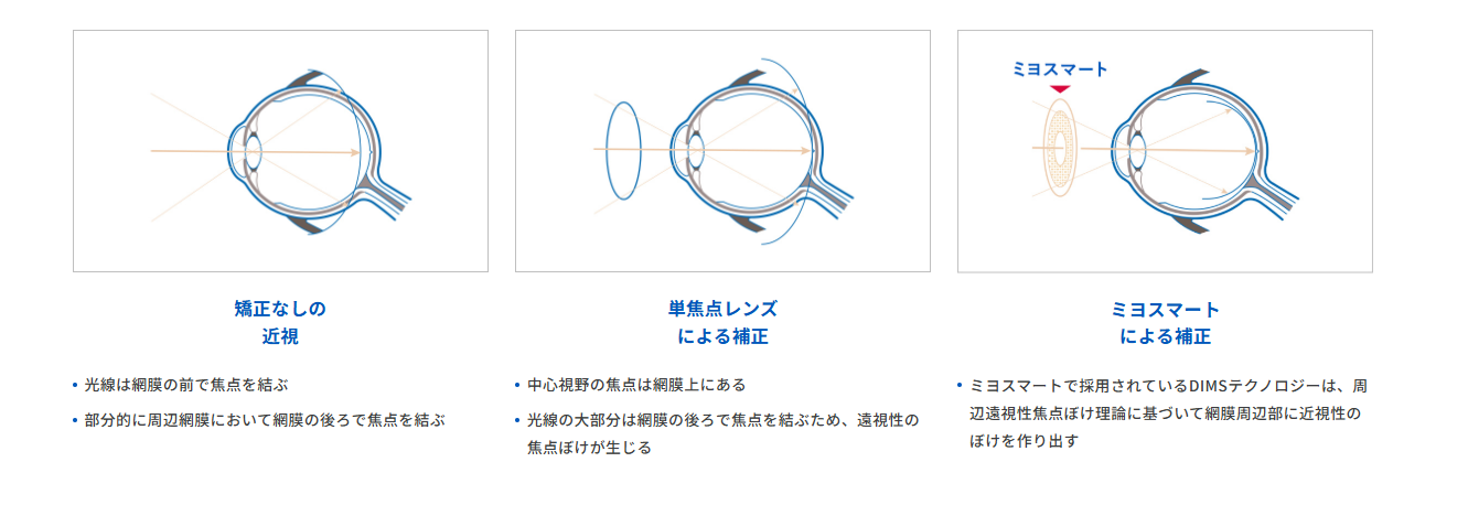 ミヨスマート
